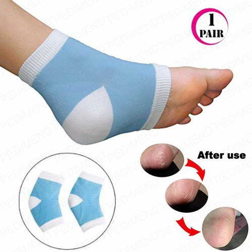 Pedimend 1pair gel - 1pair,